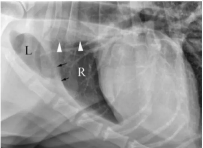 Figure 21 : Radiographie latérale gauche du thorax d'un chien normal. 