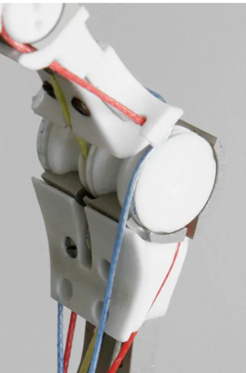 Figure 5.3: Dislocatable hinge joint for the PIP and DIP joints