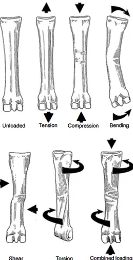 Figure 8 : Les différents schémas de forces qui peuvent s’exercer sur l’os métacarpien  III chez le cheval