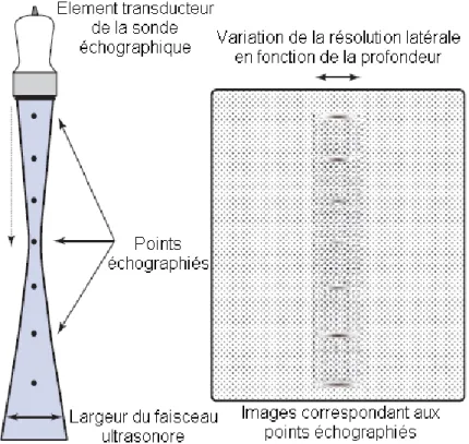 Figure 21 : Résolution latérale, noter la variation de largeur d’une même structure en fonction de la profondeur du  faisceau ultrasonore, d'après (Bushberg, Boone 2011) 