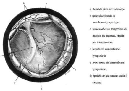 Figure 8 : Anatomie de la membrane tympanique d'un chien observée à travers un ototscope  (d’après Gotthelf, 2005) 