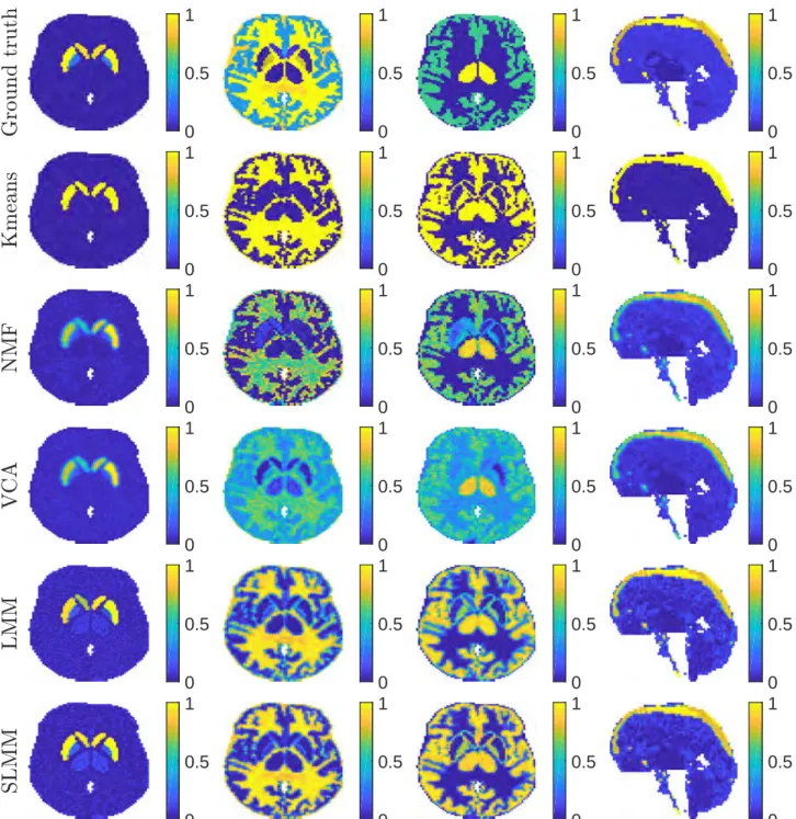 Figure 3.12.: Factor proportion maps of the 15 th time-frame obtained for SNR=15dB corresponding to the