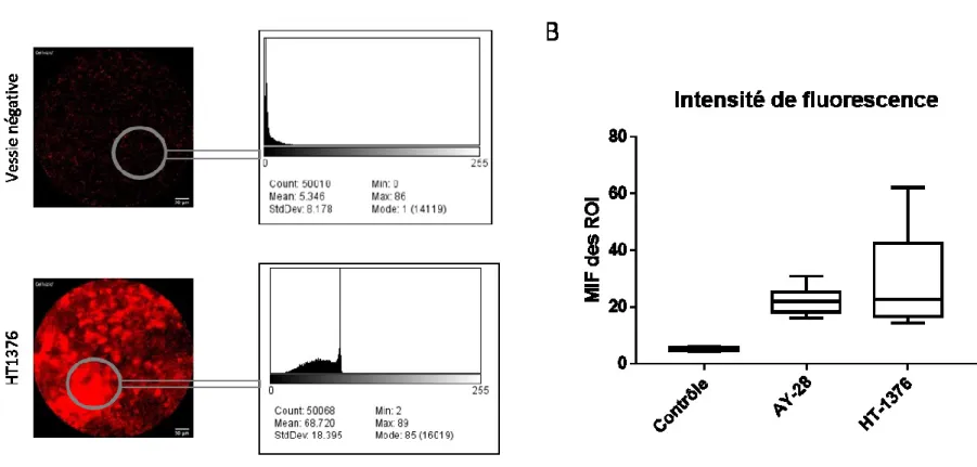 Figure  8. Quantification  de la fluorescence des images fixes obtenues par vidéo lors du  protocole  d’imagerie  par  fluorescence 