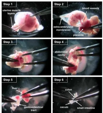 Figure 1. Key steps of the dissection procedure.  Step 1. With fine forceps, remove the  uterine muscle layers