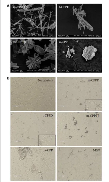 FIGURE 1 | Physicochemical and morphological characteristics of the four CPP phases. (A) SEM micrographs of the four synthetic pure CPP phases tested in this study (scale bar = 2 µm)