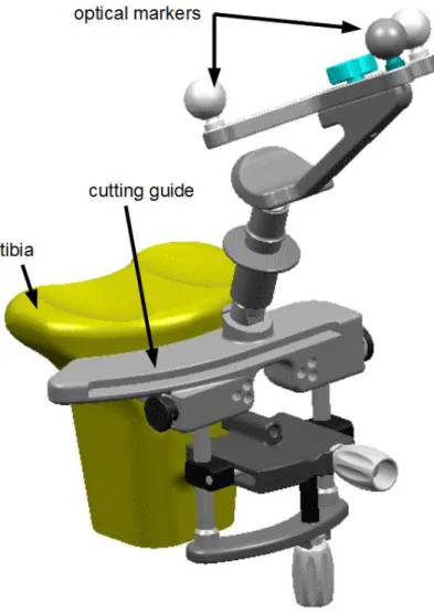 Figure 1.2: cutting guide. Copyright Aesculap AG