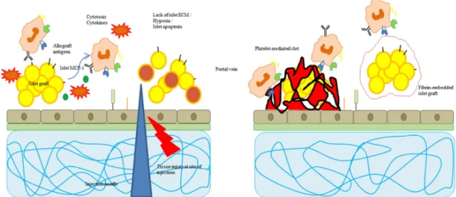 Figure 2.2: Schematic presentation of the immune response during islet grafting (left), instant  blood-mediated  inflammatory  reaction  (IBMIR)  and  islet  encapsulation  (right)