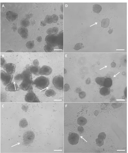 Figure  4.1:  Morphology  of  young  porcine  endocrine  pancreatic  islets  cultured  for  12  h  in  TCPS plates with no H 2 O 2  (A), 10 µM H 2 O 2  (B) and 100 µM H 2 O 2  (C)