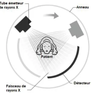 Figure 2 : Mouvement du couple source-détecteur autour du patient 