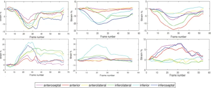 Fig. 8. Strain curves of in vivo sequences: circumferential (top row) and radial (bottom row) strains of (a) the healthy sequence, (b) the patient n°1 and (c) the patient n°2.