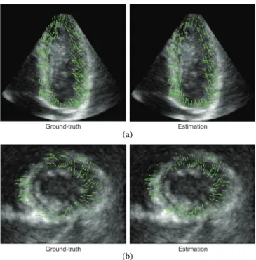 Fig. 3. Ground-truth and estimated meshes of the 5th frame of the LADprox sequence: (a) apical four chambers view, (b) short axis view.