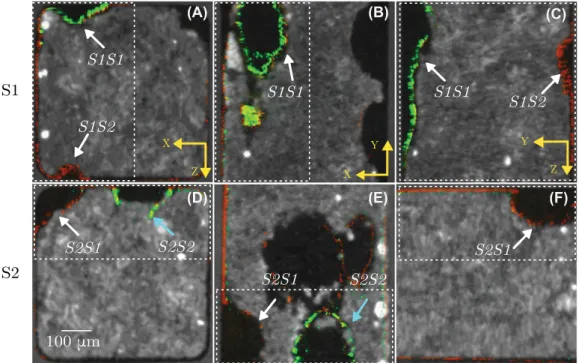 Fig.  6.  Visual comparison of TPLSM images superimposed on X-ray CMT stacks for two samples (S1 upper and S2 lower)