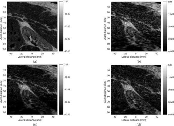 Fig. 3. (a) Ground truth of the tissue reflectivity function (TRF); (b) Observed B-mode image simulated from on the TRF in (a) using the image acquisition model in (1) employing the spatially-variant convolution operation based on the prototype PSFs in Fig