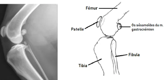 Figure I : Radiographie latéro-médiale de l’articulation du grasset de chien à gauche et  représentation schématique légendée à droite 
