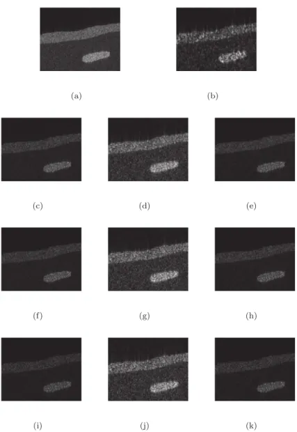 Fig. 1. Simulated US image and its compressive blind deconvolution results for a SNR of 40 dB