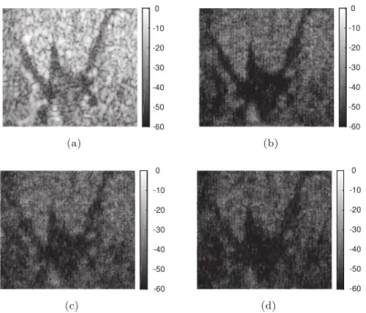 Fig. 3. Results on in vivo data. (a) Original US image, (b)–(d) reconstruction results using CSBD for CS ratios of 0.8, 0.6 and 0.4, obtained for p = 1.5.