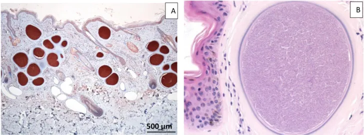 Figure  9:  A :  coupe  histologique  de  la  peau  montrant  de  nombreux  kystes  dans  le  derme  (coloration immunohistochimique avec un anticorps plolyclonal anti-Besnoitia  besnoiti)