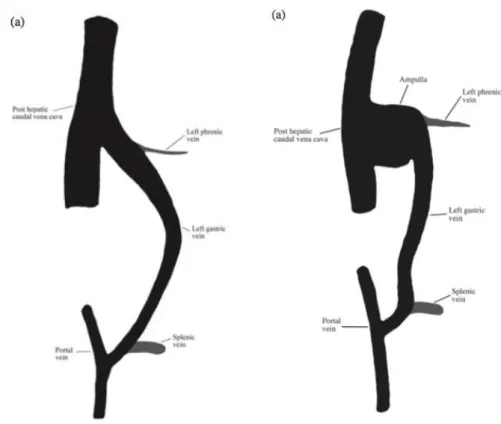 Figure 9 : Représentation schématique de l’anatomie des shunts gastro-caves gauches 