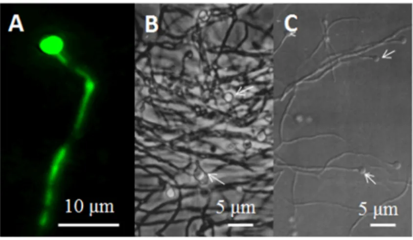 Figure  2 :  Les  vésicules  retrouvées  chez  Frankia  spp.  (A)  Une  vésicule  chez  Frankia alni  ACN14a, observée par microscopie à épifluorescence suite à une coloration au LIVE/DEAD®,  à un grossissement de 1000x