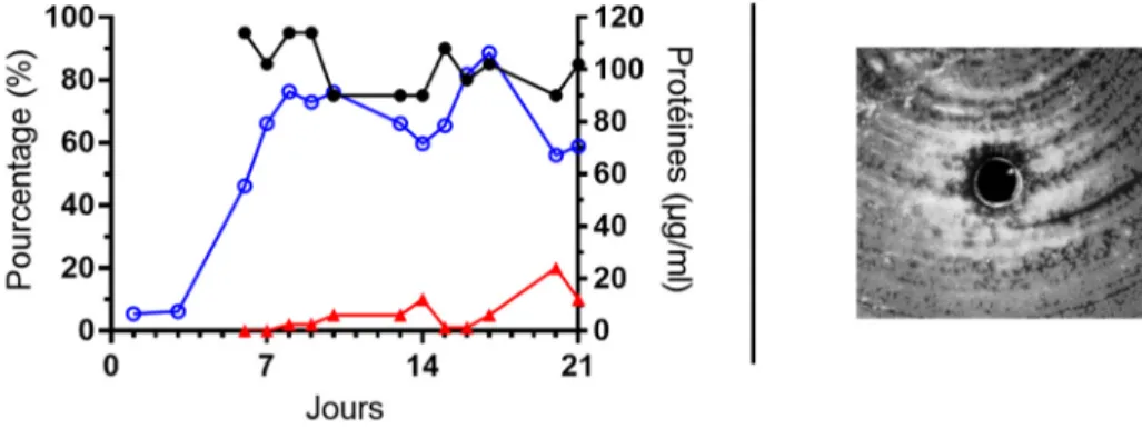 Figure 26 : Apparence des hyphes d’ACN14a aux jours 10 (A), 13 (B), 14 (C), 16 (D) et 20 (E)  en  cours  de  fermentation  1