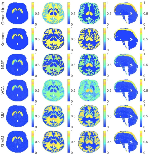 Fig.  3. Factor proportion maps of the 15th time-frame obtained for SNR = 15dB corresponding to the specific gray matter, white matter, gray matter and blood, from left to  right