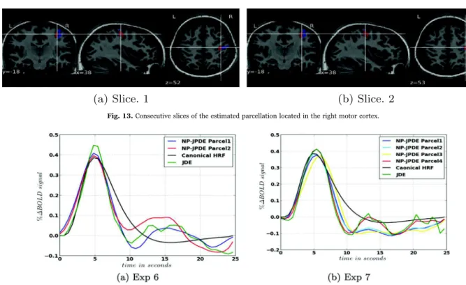 Fig. 13. Consecutive slices of the estimated parcellation located in the right motor cortex.