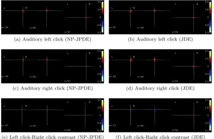 Fig. 17 shows the NRL estimates for some of the experimental conditions which are supposed to induce evoked activity in the bilateral occipital cortex (namely, video calculations and video sentences)