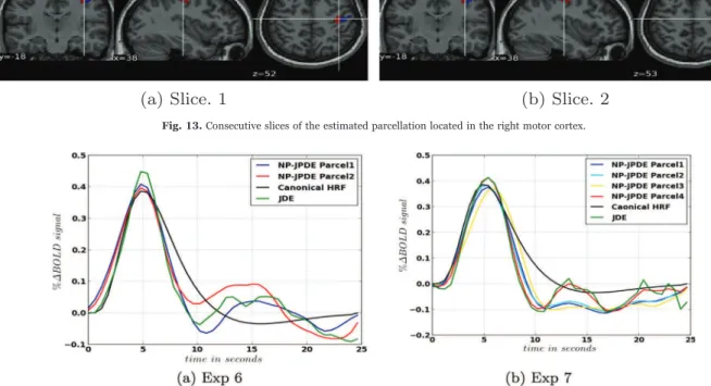Fig. 14. HRF shape estimates using the NP-JPDE and JDE models in the right motor cortex (a) and the bilateral occipital cortex (b) along with the canonical HRF.