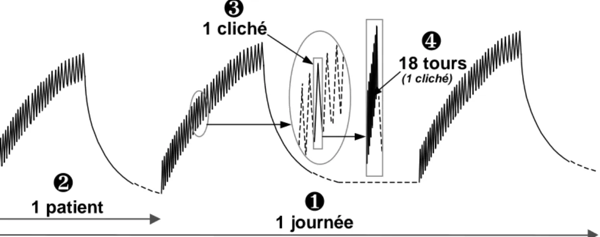 Figure 1-11: Evolution schématique de la température d’un point fixe de la couronne de l' anode lors d' une journée d' examens.