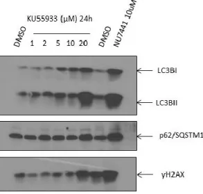 Figure 16. Comparison of the impact of DNA-PK inhibitor and ATM inhibitor on  autophagy markers in PDAC cells 