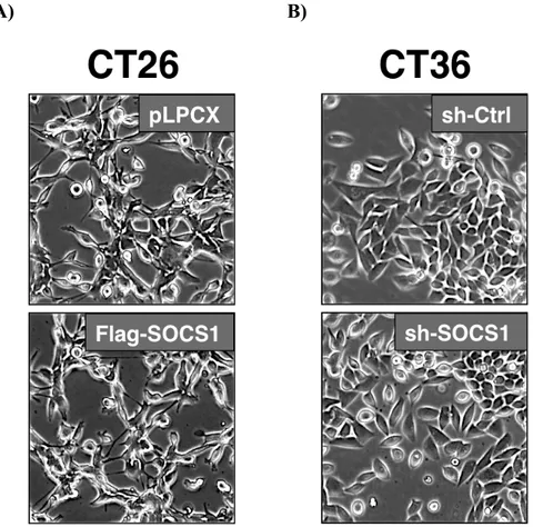 Figure  9.  La  modulation  de  l’expression  de  SOCS1  n’affecte  pas  la  morphologie  cellulaire du modèle CT26/CT36 