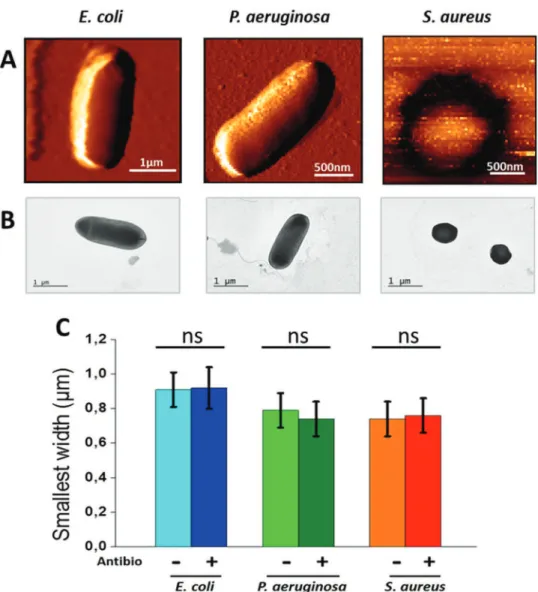 Fig. 1. Bacteria Morphology observed by AFM (A) and TEM (B and C). From left to right, morphology data of E