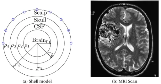 Figure 2.2: Shell and realistic brain model representations.