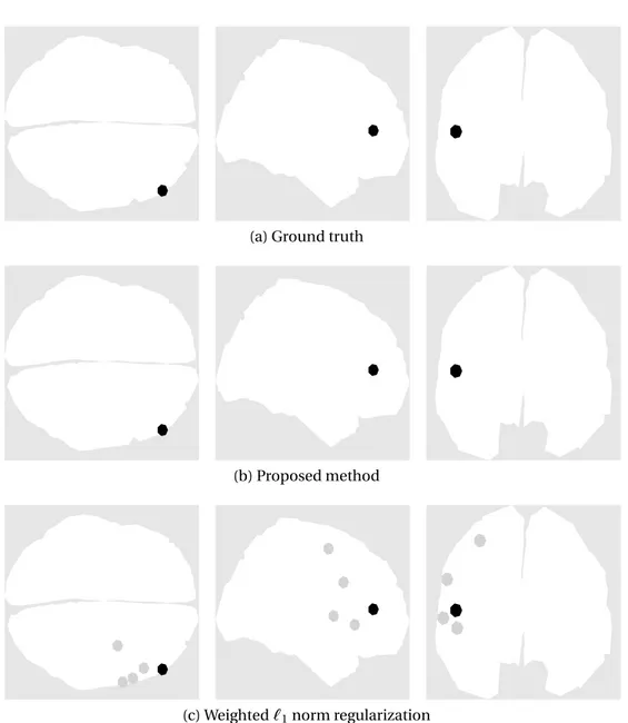 Figure 3.3: Brain activity for one single dipole experiment (activation #5).