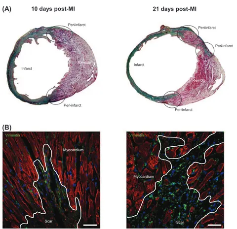 Fig. 1. (A) Masson's trichromic staining was used to distinguish remote (in red; cardiac muscle ﬁbers), peri- and infarcted tissues (in green; collagen)