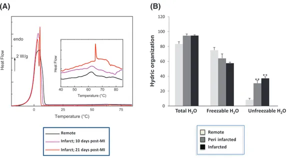 Fig. 7. DSC thermograms (A) and bar graph of the hydric organization (B) of remote, peri- and infarcted myocardial tissues (fresh tissues)