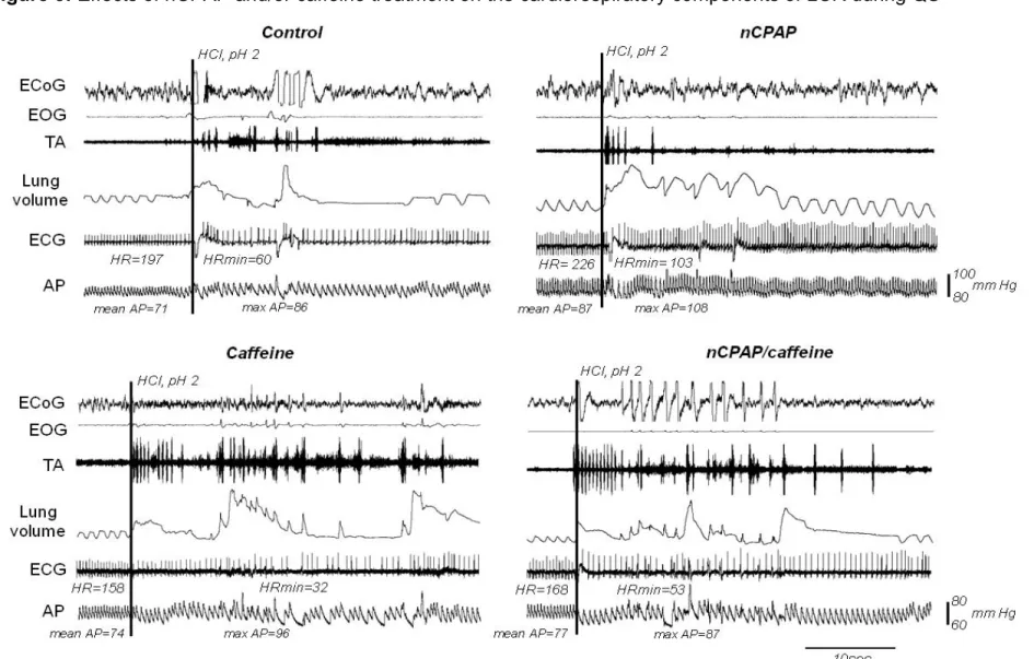 Figure 3: Effects of nCPAP and/or caffeine treatment on the cardiorespiratory components of LCR during QS 