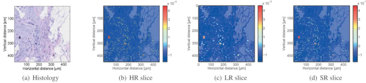 Fig. 1. Simulation result from a histology section (a) showing one (x 1 , x 2 ) slice extracted from (b) the true high-resolution (HR), (c) the