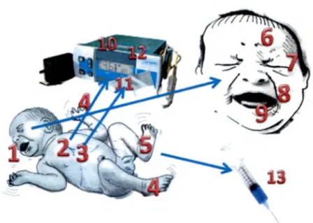 Figure 4 : Signes de douleur chez les enfants 