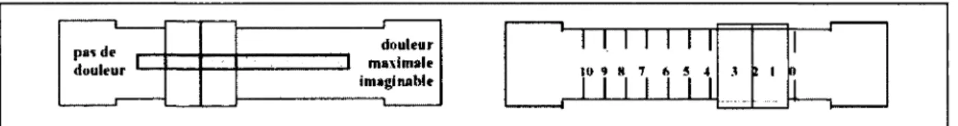 Figure 3 : Echelle visuelle analogue 