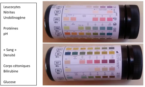 Figure 7 : échelle colorimétrique de la bandelette C 