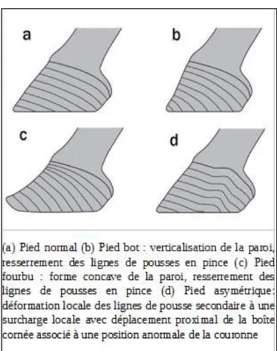 Figure 30 : Modifications de la boite cornée en vue de profil (d'après O’Grady S.) 