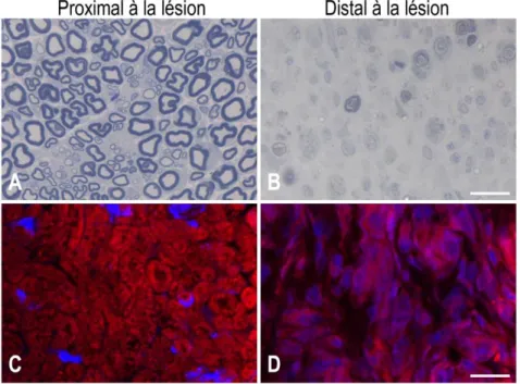 Figure 4 : Processus de dégénérescence Wallérienne dans le nerf sciatique d’un rat.  