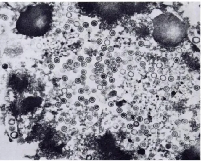 Figure 5 : Cliché au MET  d’un virus enveloppé mature isolé chez un pigeon domestique  (barre = 200 nm) (Zhao et al