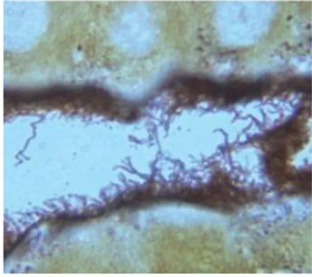 FIGURE 3 Photomicrograph of a Warthin-Starry stained section of kidney tissue from sewer rat