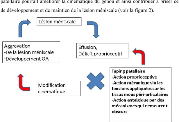 Figure 2 : Schématisation du cadre théorique de l’action du TP lors d’une lésion  méniscale 