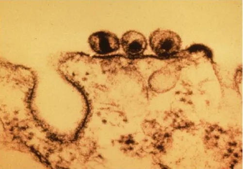 Figure 8 : Particules de l’EIAV émises de la membrane d’un macrophage infecté (microscope électronique en transmission)  d’après Sellon et al., 2007