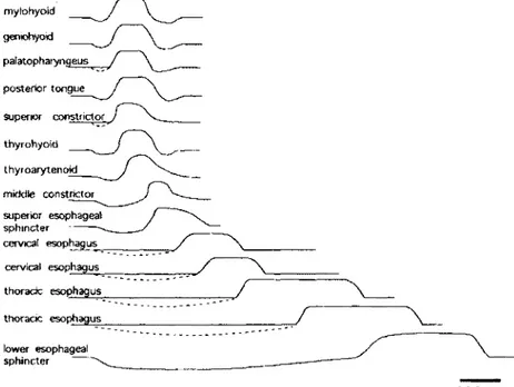 Figure  1  :  Étude  électromyographique  montrant  la  séquence  d’activation  motrice