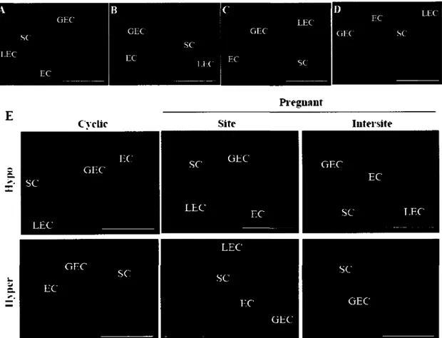 FIG. 3. Cadherin 13 protein expression in the sow endometrium throughout the estrous cycle  (A, stage 1; B, stage 2; C, stage 3; and D, stage R) and in hyper- and hypoprolific sows (E)