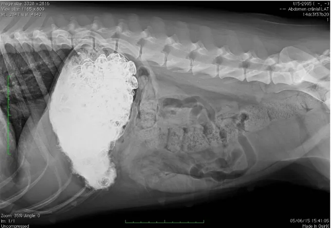 Figure 11 : Radiographie de profil à T0+2h – Transit baryté 